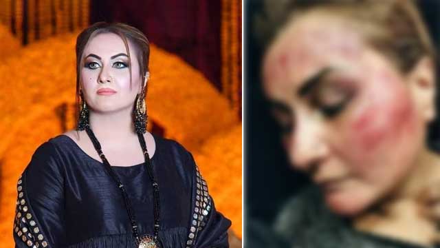 اداکارہ نرگس کو شوہر نے تشدد کا نشانہ بناڈالا