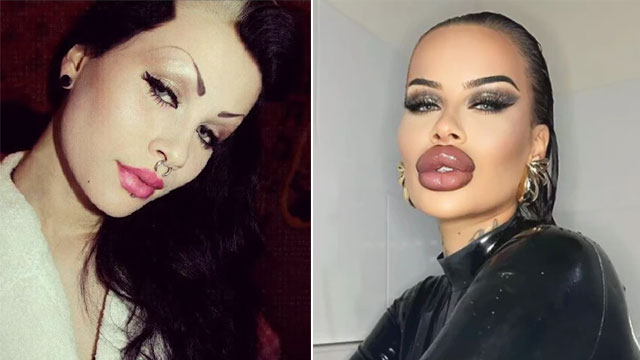 باربی بننے کا جنون؛ ماڈل نے کروڑوں کی سرجریز کروا ڈالیں