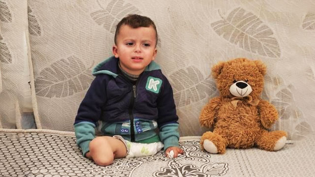 غزہ جنگ؛ کتنے ہزار فلسطینیوں کے ہاتھ، پاؤں کاٹے گئے؟ تہلکہ خیز انکشاف