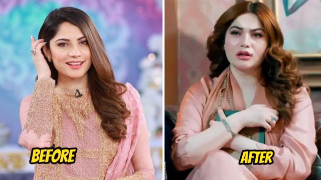 "کیا کاسمیٹک سرجری کروائی ہے، نیلم کا چہرہ بدل گیا”