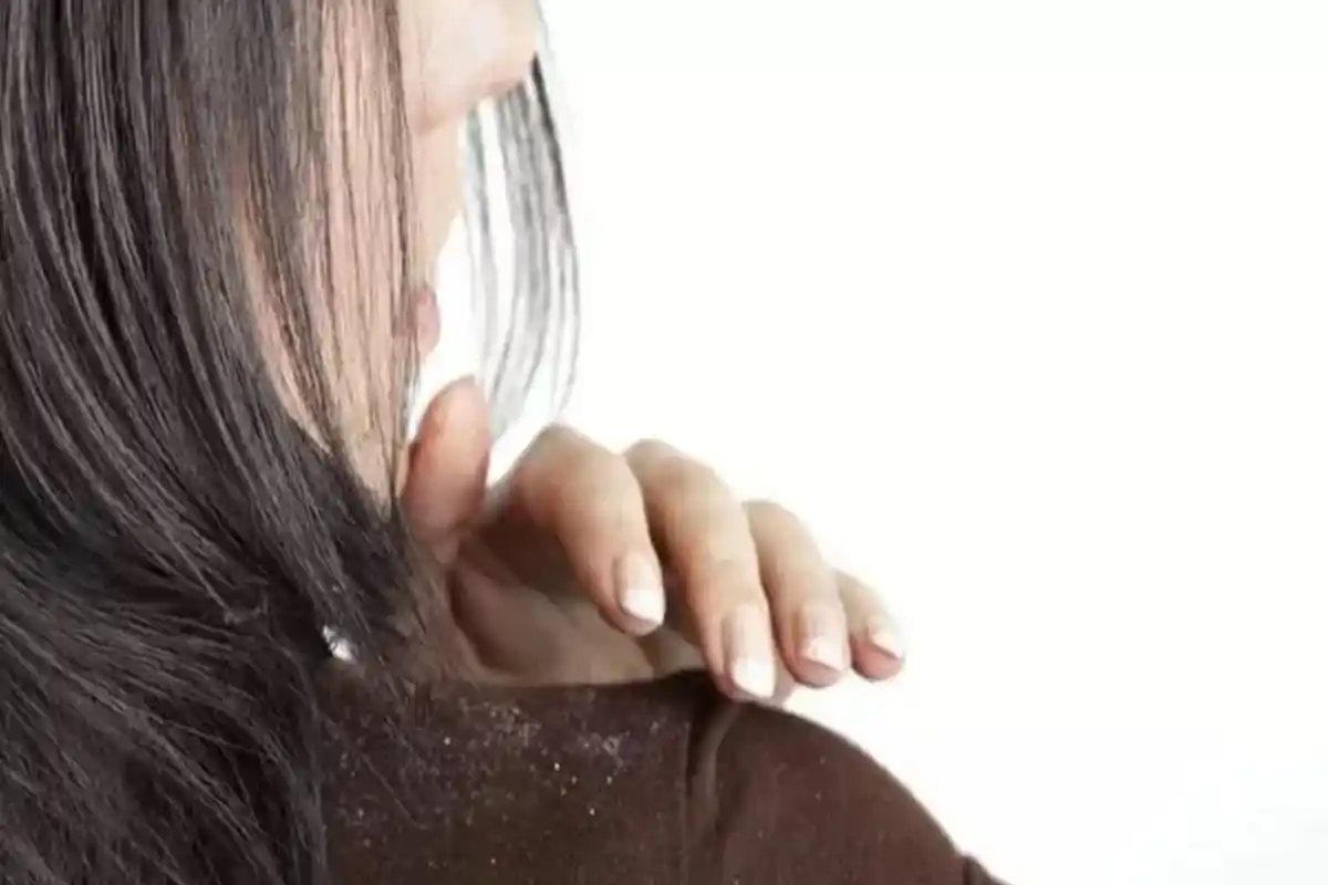 بالوں سے خشکی ختم نہ ہونے کی اصل وجہ سامنے آگئی