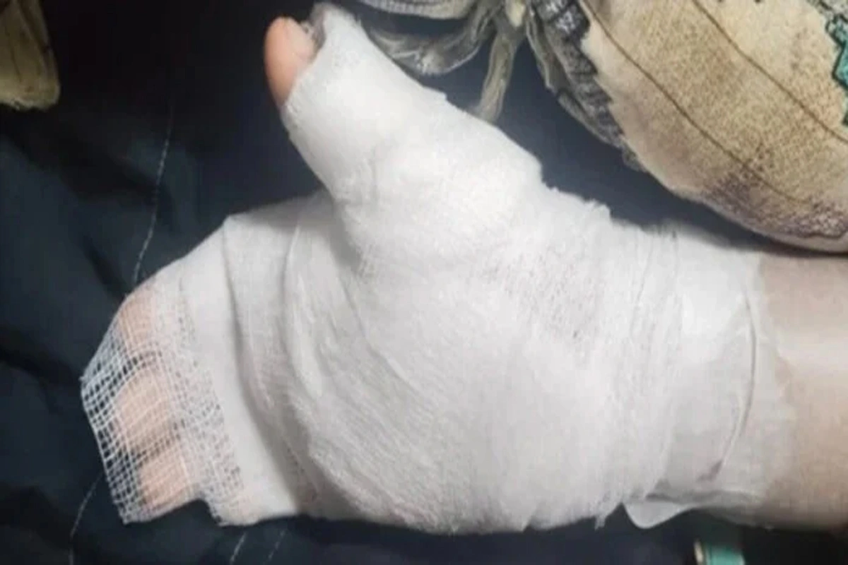 ہینڈ رائٹنگ ٹھیک نہ ہونے پر ٹیچر نے 8 سالہ طالب علم کا ہاتھ جلا دیا