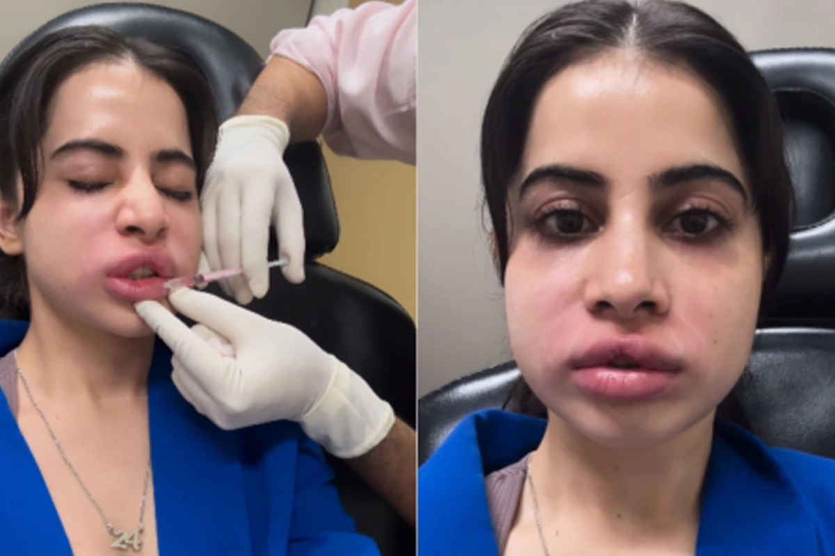 اداکارہ عرفی جاوید کو سرجری کرانا مہنگا پڑ گیا، چہرہ پہچاننا مشکل