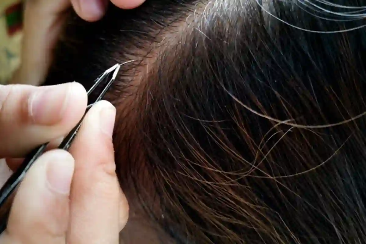 ایک سفید بال توڑنے سے باقی بھی سفید کیوں ہوجاتے ہیں؟ سائنسی حقیقت سامنے آگئی