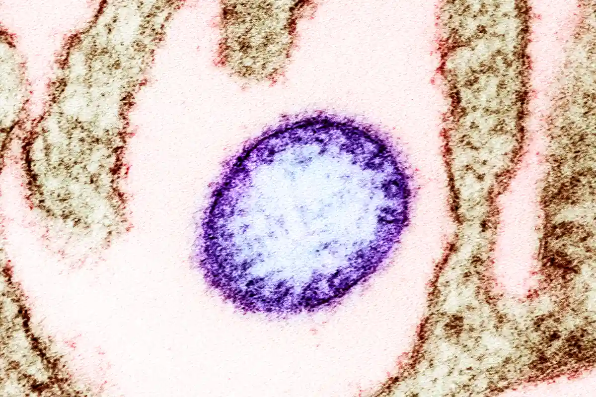 نیپاہ وائرس کیسے پھیلتا ہے اور اسکی علامات کیا ہیں؟ محکمہ صحت نے ایڈوائزری جاری کردی