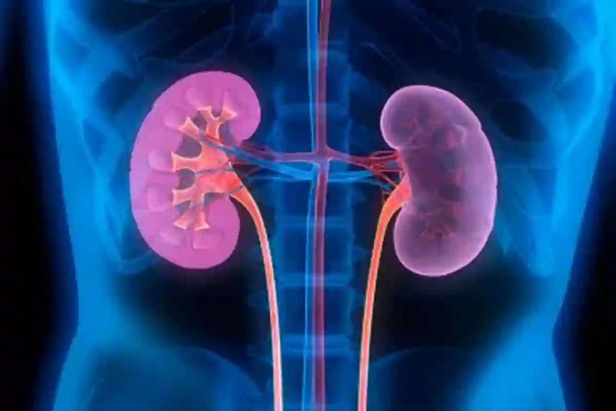 گردے کے امراض میں خطرناک حد تک اضافہ، محفوظ رکھنے کے 10 مؤثر طریقے سامنے آگئے