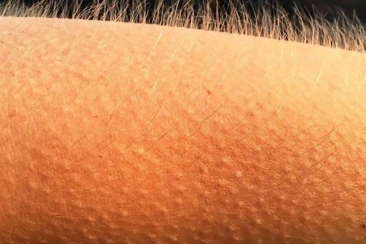 جسم میں کرنٹ دوڑنے یا رونگٹے کھڑے ہونے کا کیا راز ہے؟ ماہرین نے بتادیا