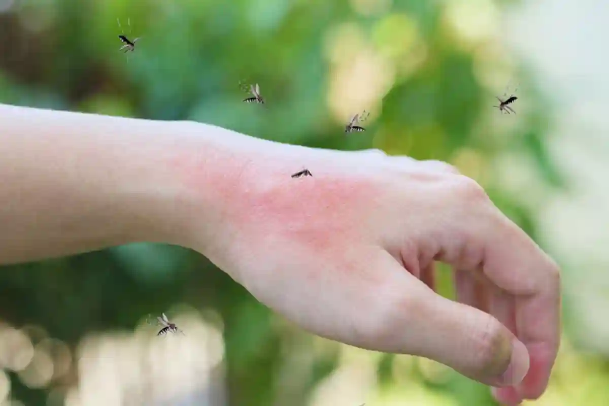 مچھر کیوں کاٹتے ہیں؟