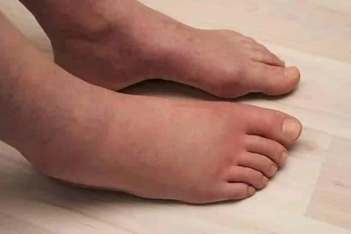 اگر آپ کے پاؤں یا ٹخنوں میں آرام کے باوجود مسلسل سوجن رہ رہی ہے تو اسے نظر انداز نہ کریں!! ماہرین نے خطرے کی گھنٹی بجادی