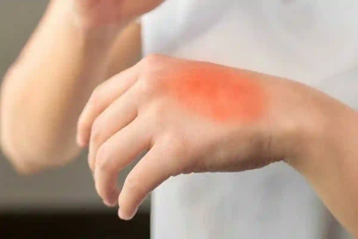 جلنے کے فوراً بعد یہ عام گھریلو چیز لگانا خطرناک ثابت ہوسکتا ہے!