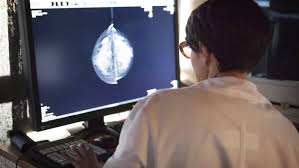 Google AI beats people when finding breast cancer