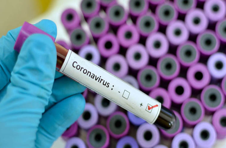 Coronavirus related measures adopted all over Pakistan