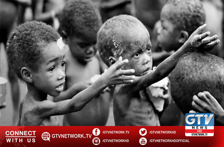 Over 10 million children to face acute malnutrition in 2021: UN