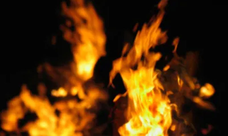 Karachi: Father burns son for an ‘Unsatisfactory answer’ about studies
