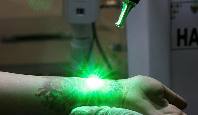 Muslims removing tattoos in Ramazan