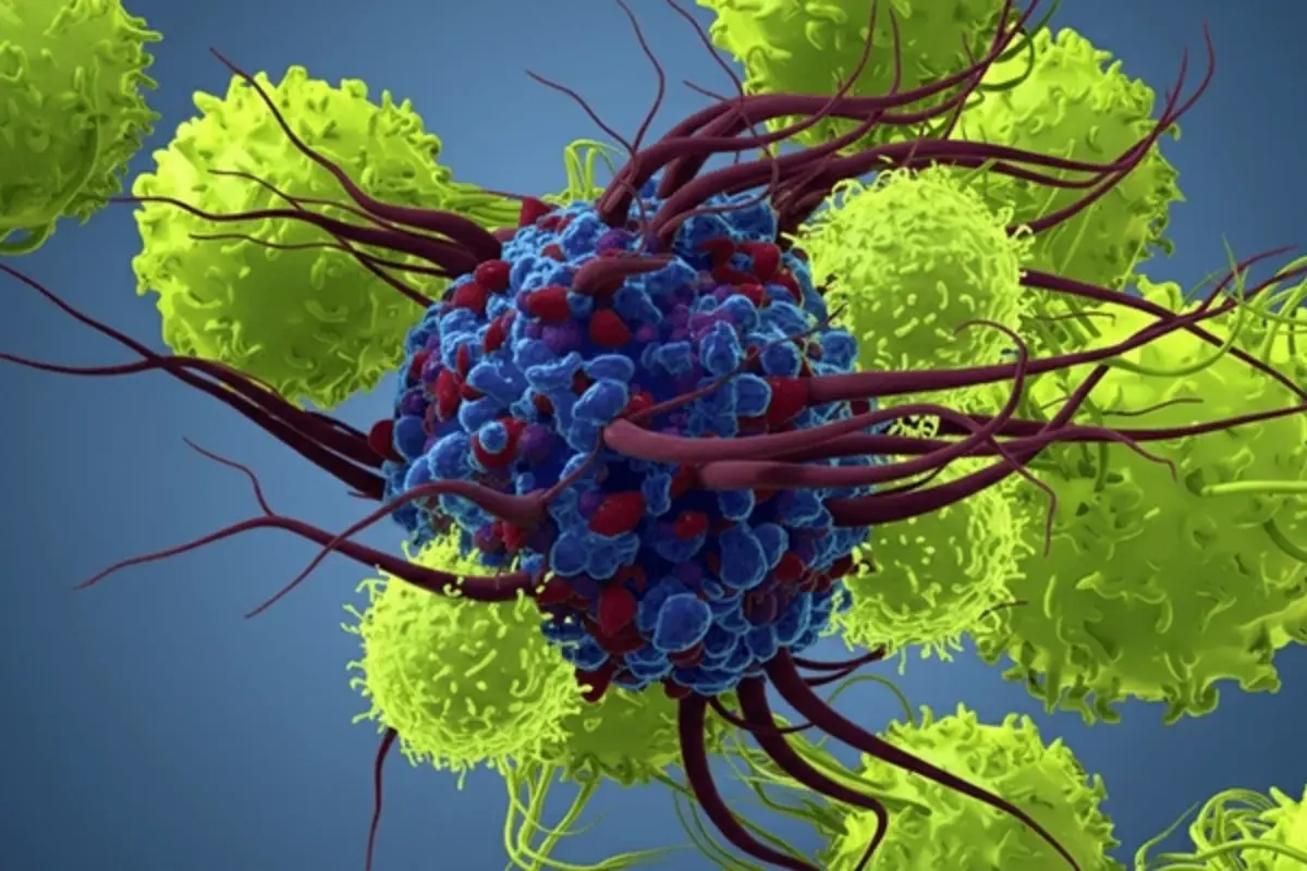 Pakistan Successfully Performs First CAR T-Cell Therapy, Marking Major Medical Milestone