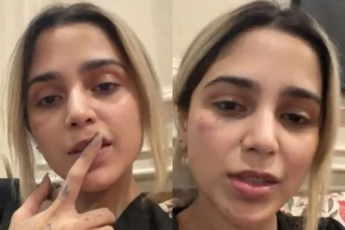Aima Baig Reassures Fans After Facial Bruise Sparks Concern